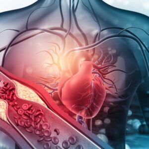 ANGIOPLASTIA-TRANSLUMINAL-DA-AORTA-OU-RAMOS-OU-DA-ARTERIA-PULMONAR-E-RAMOS