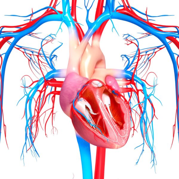 RECANALIZAÇÃO MECÂNICA DO IAM (ANGIOPLASTIA PRIMÁRIA COM BALÃO)